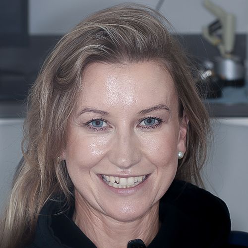 composite bonding - before - Carmen - 3dental